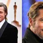 What actor had 5 hair transplants?